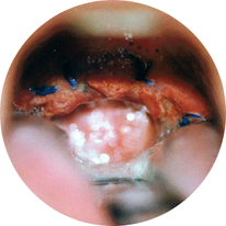 uvulo qudro.png